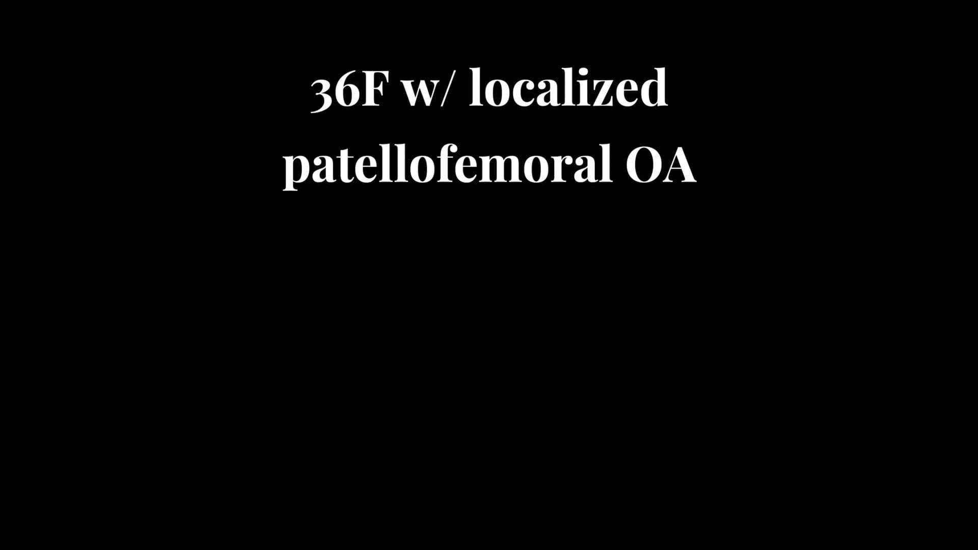 Patellofemoral Arthroplasty