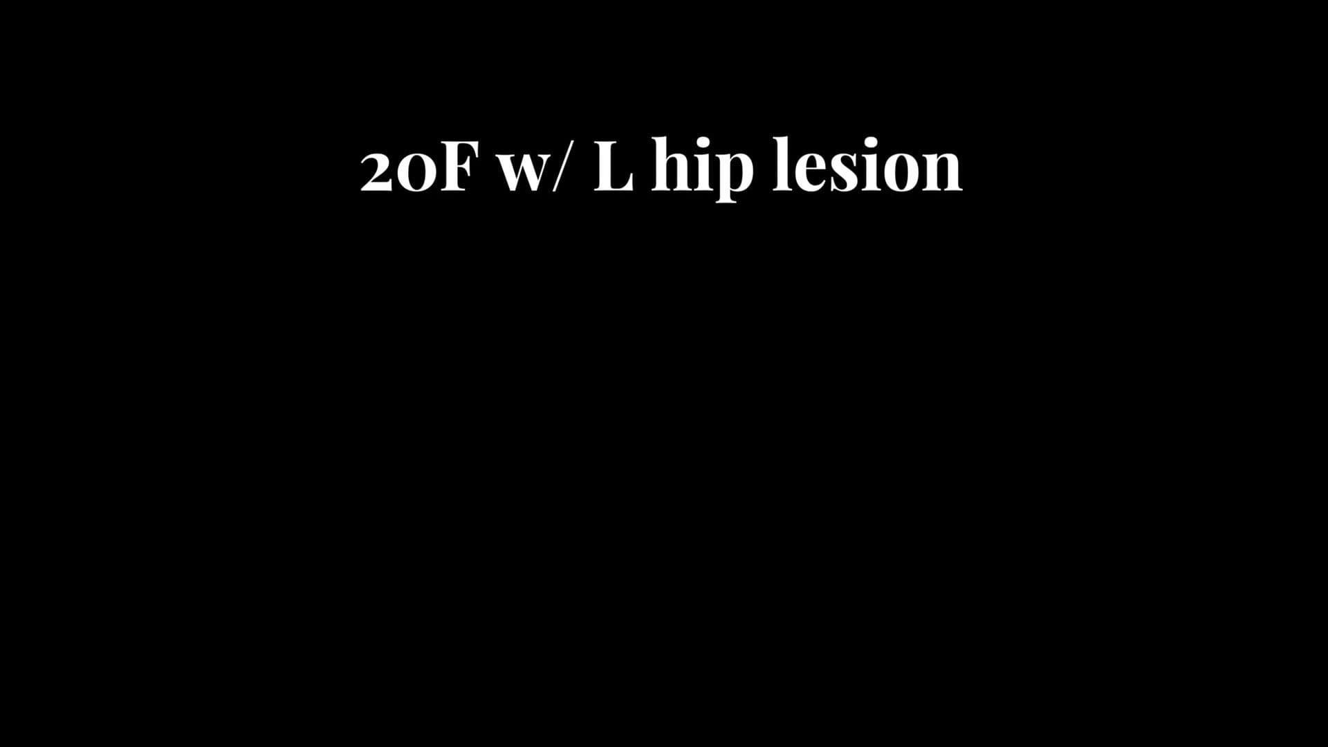 Surgical Hip Dislocation