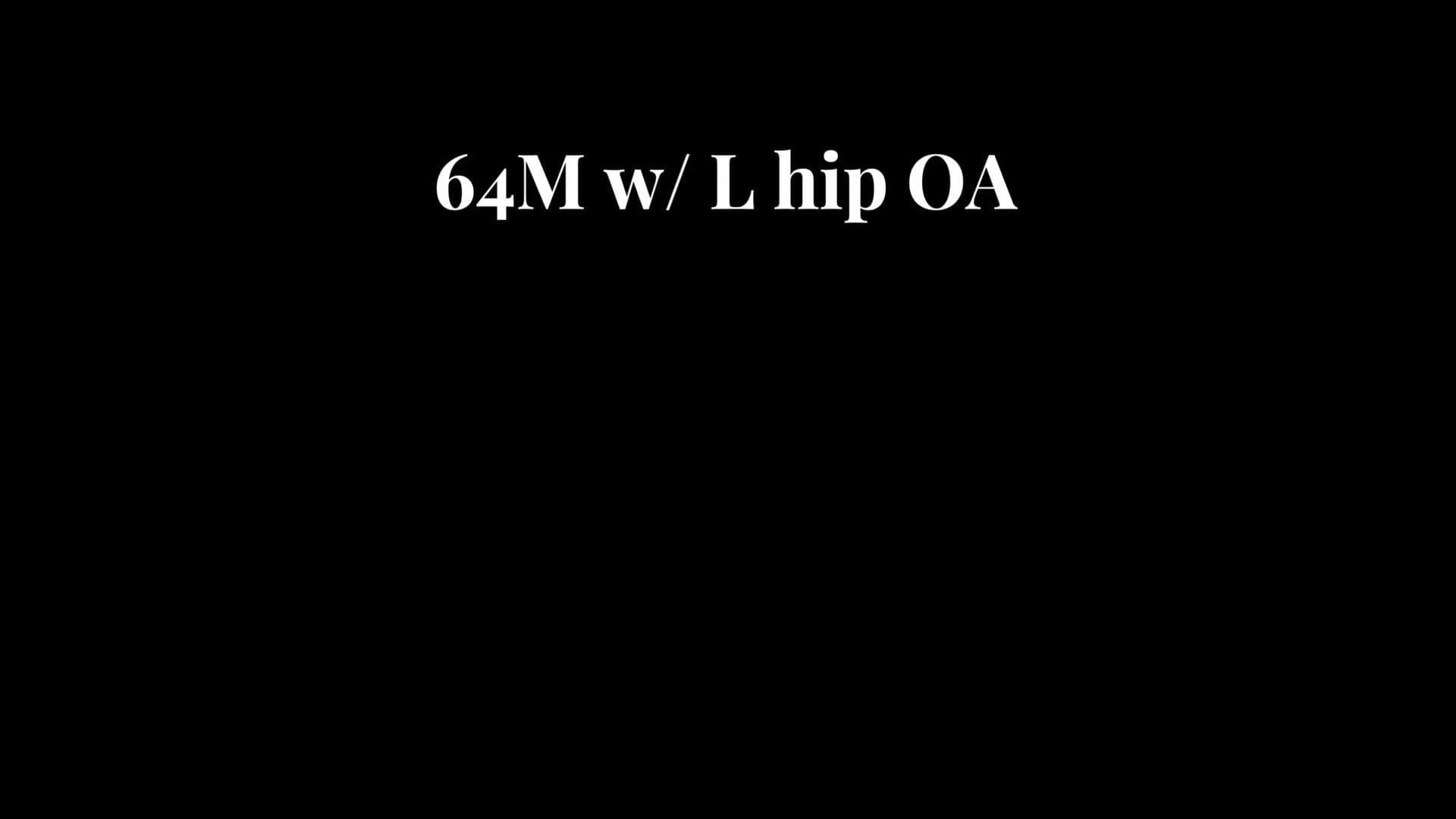Total Hip Arthroplasty (Posterior)