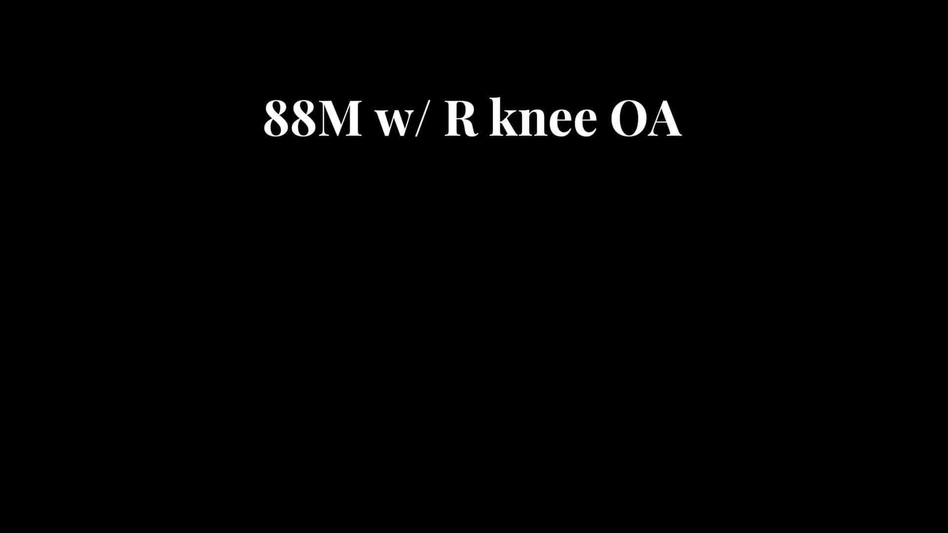 Total Knee Arthroplasty