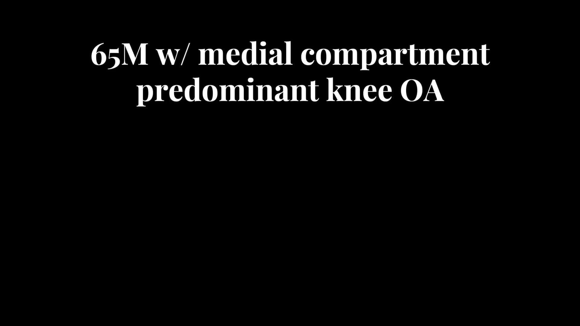 Unicompartmental Knee Arthroplasty